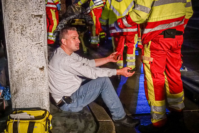 Ein Mann sitzt mit verbrannt-geschminkten Händen an einer Säule vor Notfallsanitätern.